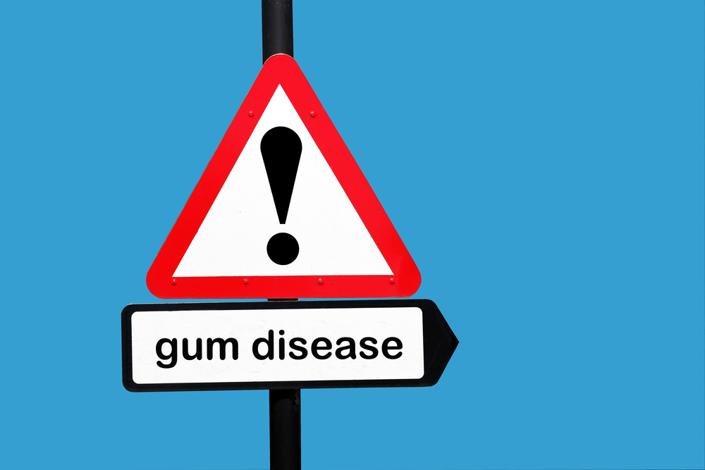Gum Disease: Who is at Risk?