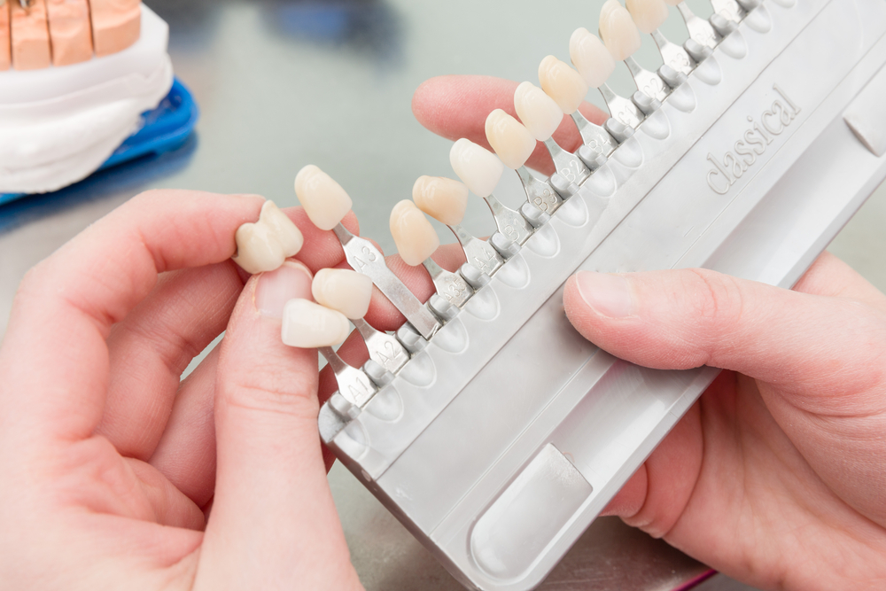 How You Can Benefit From Porcelain Veneers