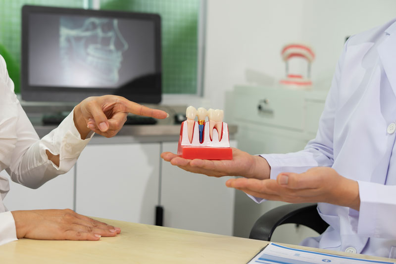 Understanding Dental Implant Metal: Materials, Longevity, and Success